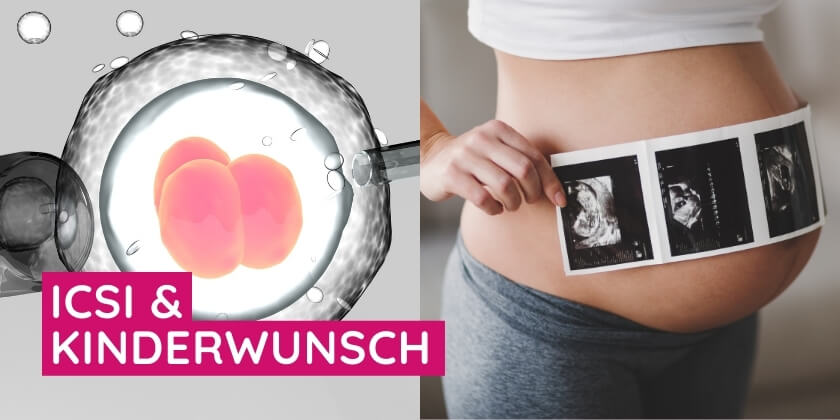 ICSI Künstliche Befruchtung