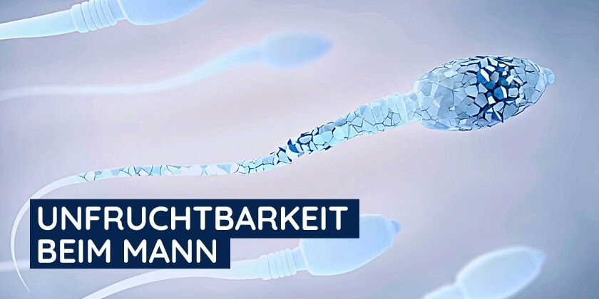 Gesplittertes Spermium als Darstellung für Unfruchtbarkeit beim Mann
