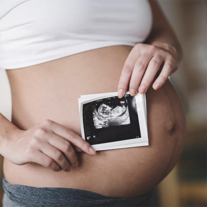 BabyFORTE bei Kinderwunsch & Schwangerschaft auch ohne Jod erhältlich